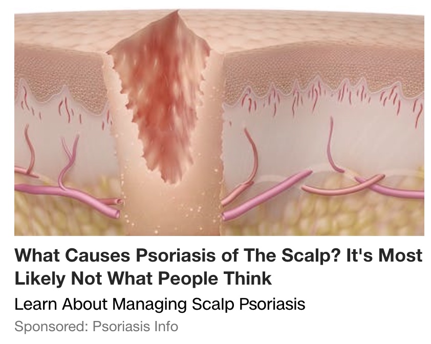 Psoriasis